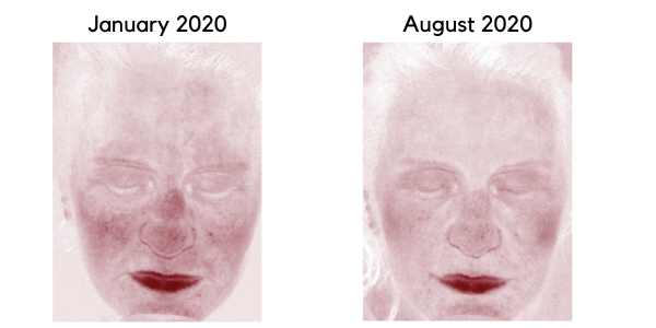 Lone skin scan result